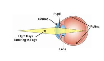Common Vision Questions